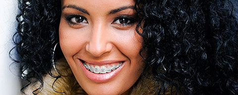 Young black woman from Greenwich smiling with fixed orthodontics braces
